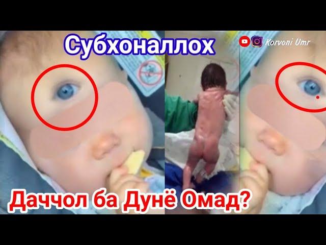 Имруз! Дар Дунё   ДАЧЧОЛ ба Дунё Омад СУБХОНАЛЛОХ