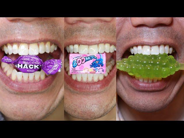 A Doctor Chewing On Candy & Chocolate for 20 Minutes