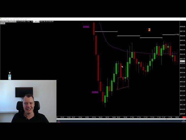 Die einzige Scalping Trading Strategie, die du brauchst 