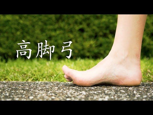 《高脚弓》你知多少？