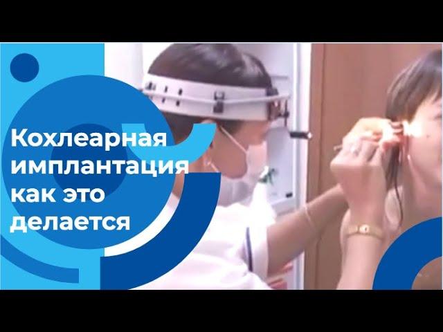 Кохлеарная имплантация: как восстановить слух и вернуть радость жизни