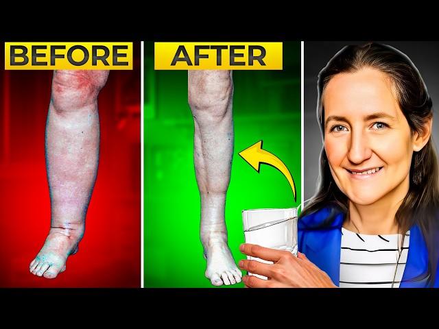 URGENT! Barbara O'Neill EXPOSES The Instant FIX for Swollen Feet & Legs