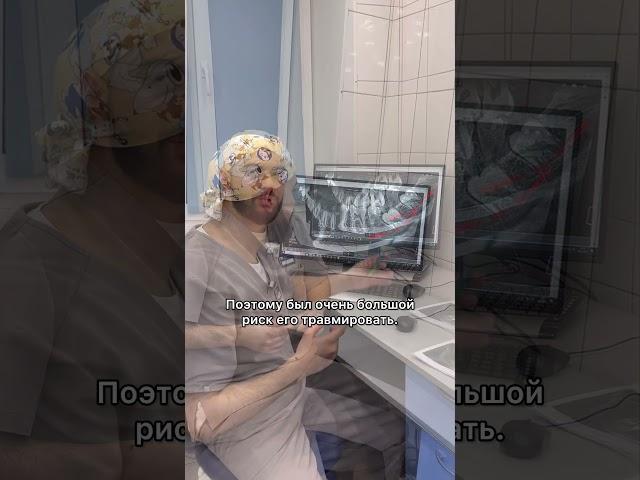 Рассказываем про сложное удаление зуба мудрости
