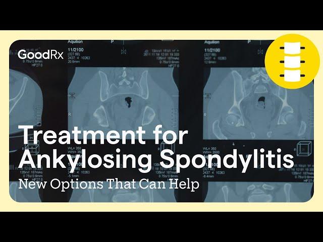 Treatment for Ankylosing Spondylitis: New Options That Can Help | GoodRx