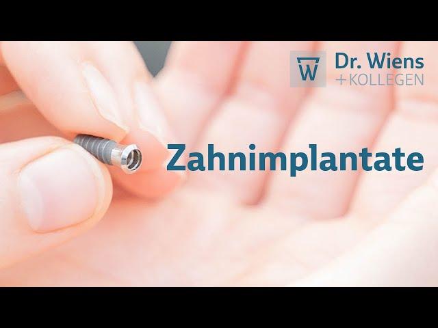 Zahnimplantate: Das sollten Sie wissen!