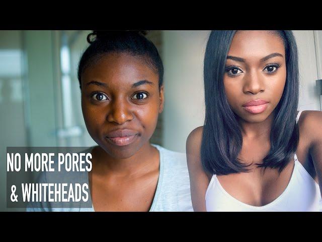 HOW I CLEARED MY SKIN & GOT RID OF LARGE PORES WHITEHEADS & ROUGH TEXTURE