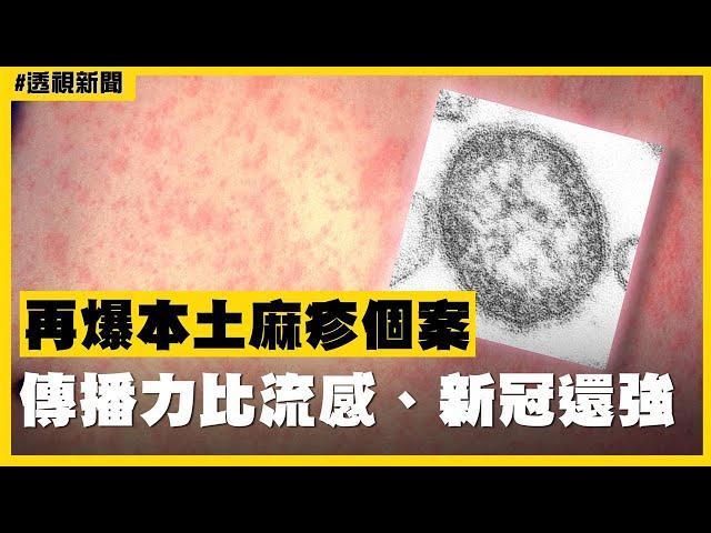 透視新聞／再爆本土麻疹個案　傳播力比流感、新冠還強－民視新聞