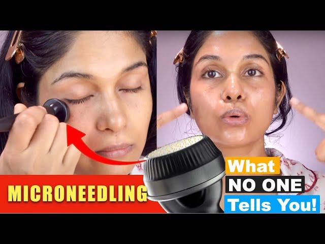 Microneedling at Home? Here is what You Should Know (Banish Microneedle)