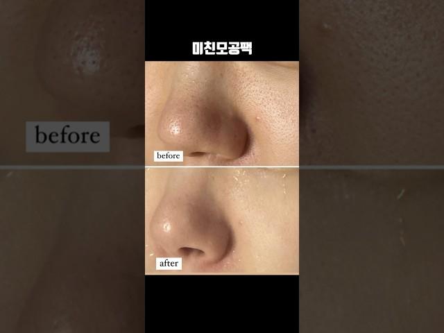 모공계의 에르메스 #미친모공팩 #홈케어 #모공관리