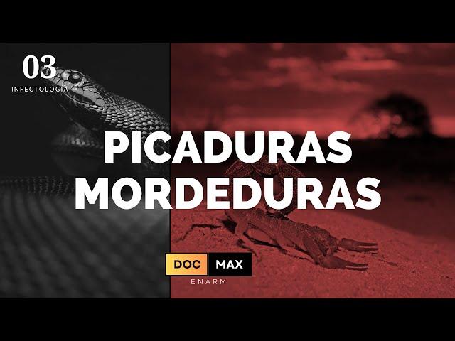 Picaduras y Mordeduras - ENARM