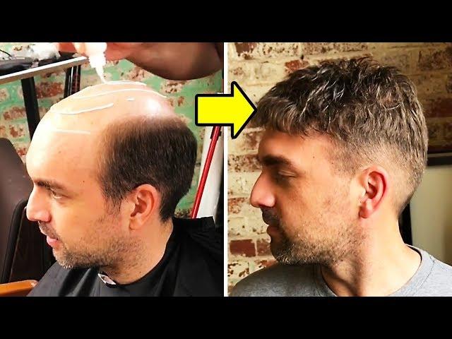 NON-SURGICAL HAIR REPLACEMENT SYSTEM FOR MEN | HAIR TRANSFORMATION