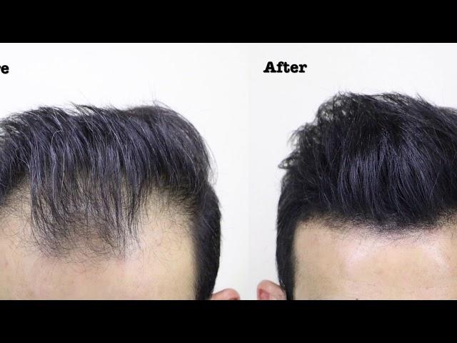 Conceal Thinning Hair with THICK FIBER- Hair Building Fibers