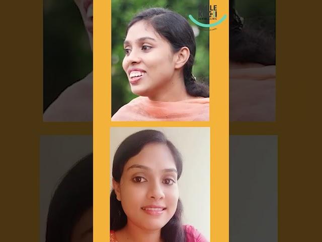 Smile Confidently Smile with Smile Kochi Dental Clinic | Kadavanthara | Palarivattom