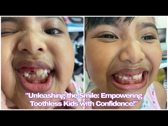 "Unleashing the Smile: Empowering Toothless Kids with Confidence!"| Yang Fam️