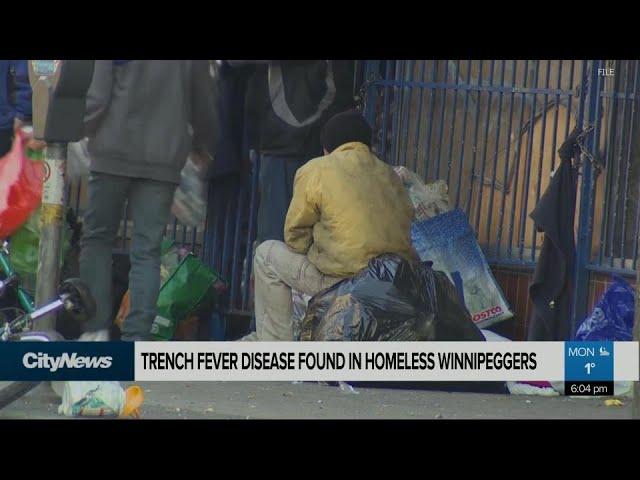 Trench fever afflicting homeless in Winnipeg