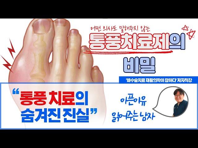 어떤 의사도 말해주지 않는 통풍 치료제의 비밀 [탑팀재활, 아픈이유 읽어주는 남자] '비수술치료 재활의학이 답하다' 두목곰 박정욱 원장 직강