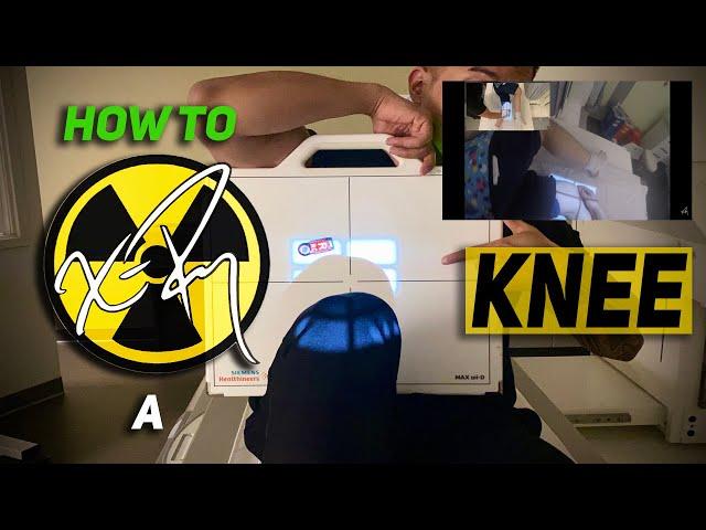 HOW TO X-RAY a KNEE | x-table | sunrise | weight bearing | lateral | positioning | radiology program