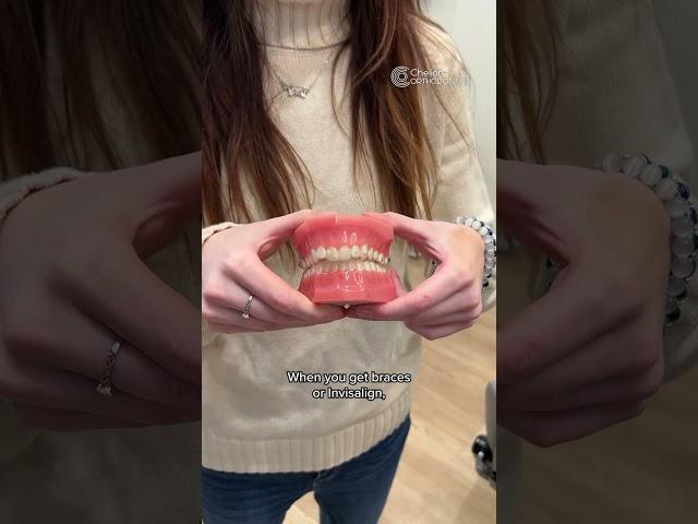 Myths about braces! Will it change your speech?