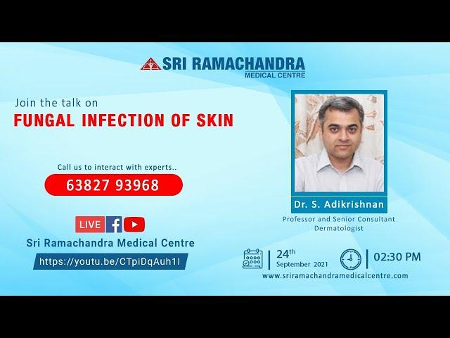 FUNGAL INFECTION OF SKIN Prevention and Treatment | Sri Ramachandra Medical Center