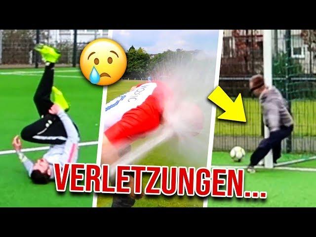 UNSERE HEFTIGSTEN VERLETZUNGEN IN FUSSBALL CHALLENGES!