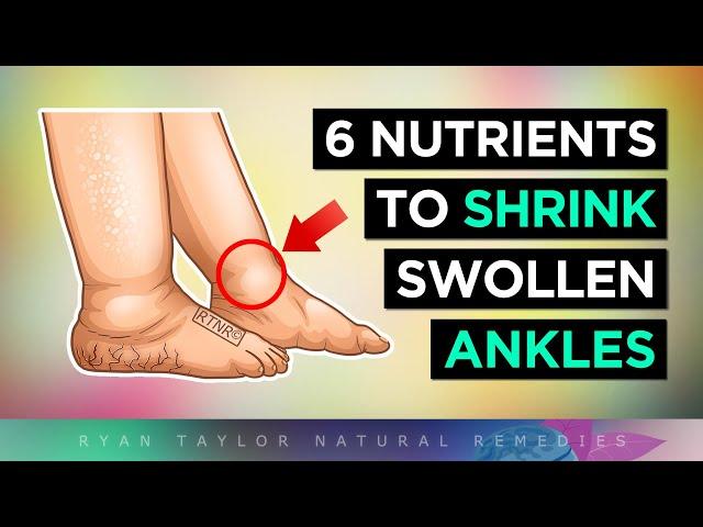 6 Nutrients To ELIMINATE Swollen Ankles & Legs