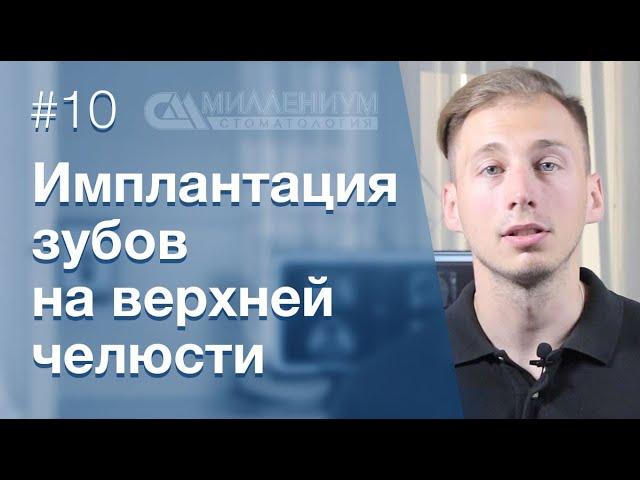 Имплантации зубов на верхней челюсти