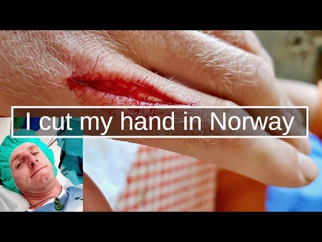 How I cut my hand in Norway & What Happened Next