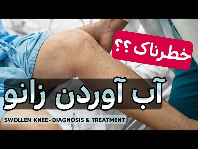 آب آوردن زانو - درمان آب آوردن زانو| How to treat knee Swelling & knee effusion