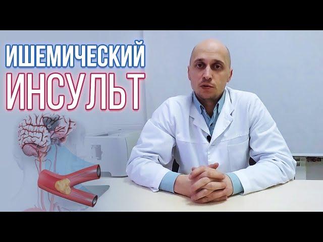 Ишемический инсульт (инфаркт головного мозга): причины, симптомы, лечение, восстановление и прогноз