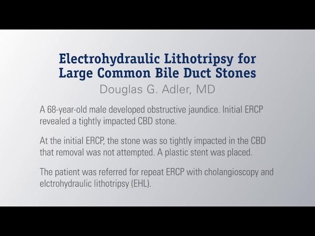 Electrohydraulic Lithotripsy for Large Common Bile Duct Stones by Dr. Adler