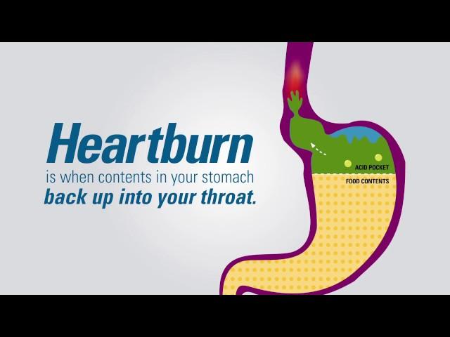 What is Heartburn?