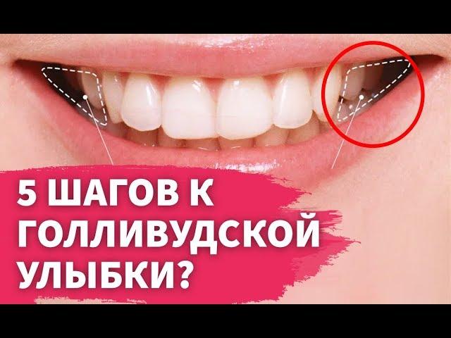 5 секретов голливудской улыбки