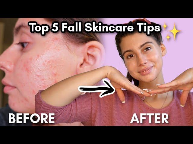 Top 5 Fall Skincare Tips that will transform your skin! 