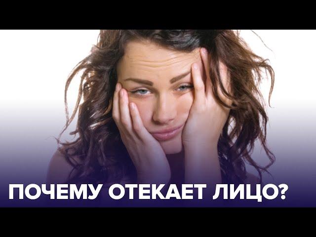 ОТЕКАЕТ ЛИЦО по утрам? Вот ГЛАВНЫЕ ПРИЧИНЫ отеков