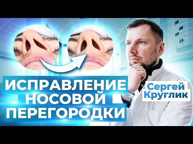 Септопластика / Как устранить искривление носовой перегородки?