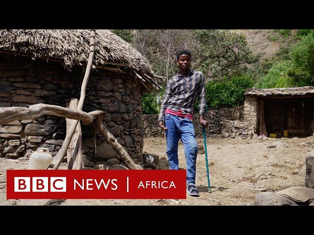 'I lost my leg on my way home from school'  - BBC Africa