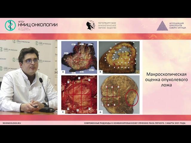 Оценка лечебного патоморфоза при немелкоклеточном раке легкого (Кушнарев В.А.)