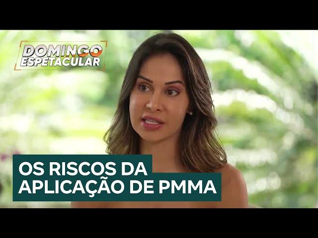 Maíra Cardi se arrepende de mudança no rosto e tenta retirar PMMA 15 anos depois