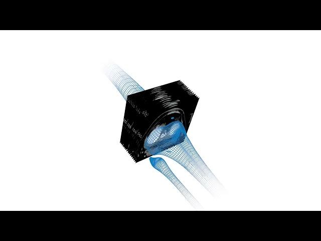 Dr. Richard L. Baumann | Stryker Mako Robot-Assisted Total Knee