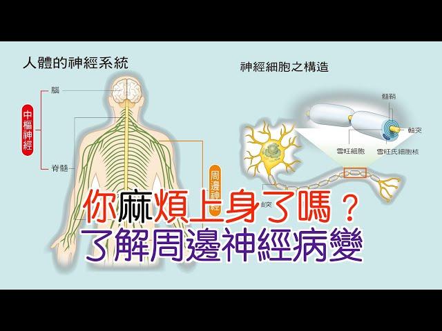 你「麻」煩上身了嗎？ 了解周邊神經病變