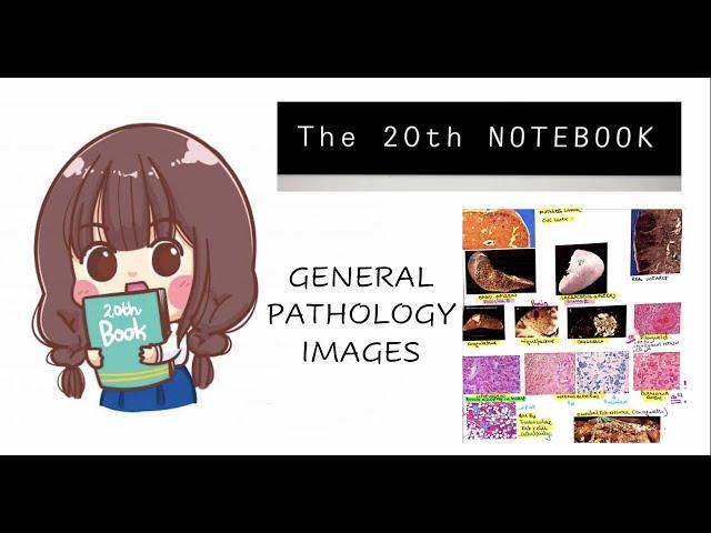 The 20th Notebook || MOST VOLATILE TOPICS || HIGH YIELD NEET PG 2022 || Part 1: Pathology Images