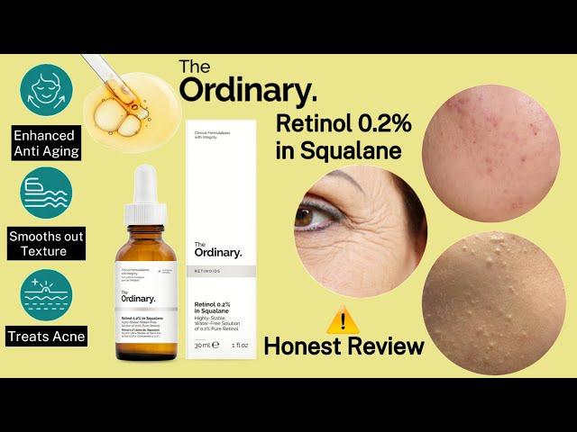 The Ordinary Retinol 0.2 in Squalane review ️|Best retinol serum | retinol for beginners