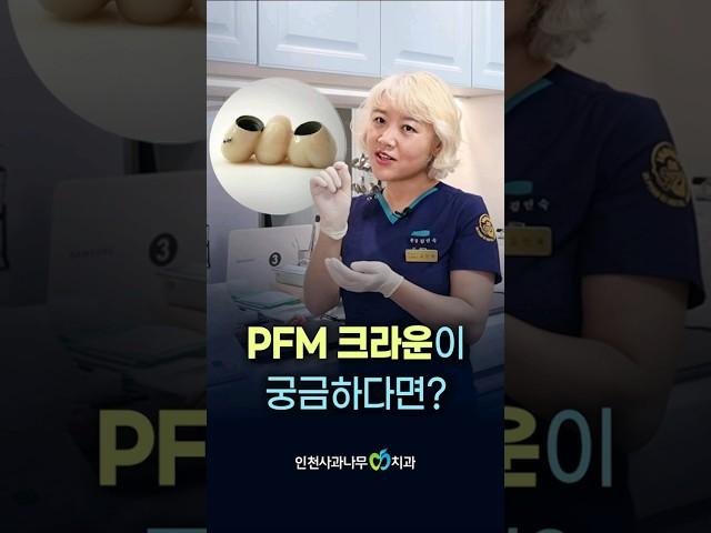 PFM 크라운의 장단점이 궁금하다면?