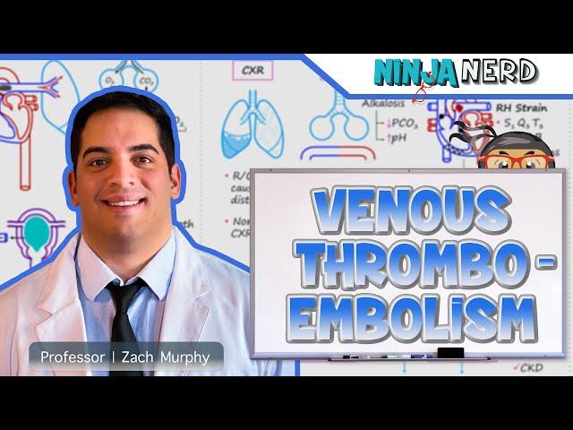 Venous Thromboembolism (DVT, PE) | Clinical Medicine