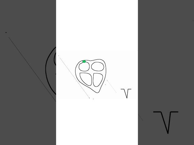 Wie entsteht ein EKG #anatomy #medstudent #science #animation #medicalstudent #biology