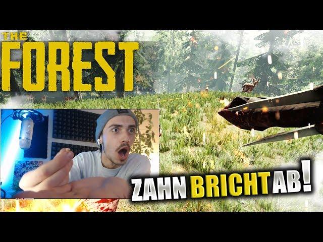 MiikaHD BRICHT ZAHN IM STREAM AB! - STREAM BEST OF 2020