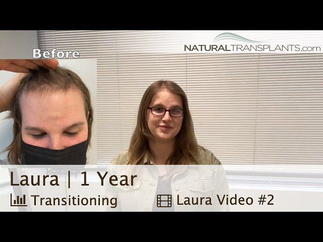 Transitioning Male to Female Hair Transplant for Feminizing Hairline | Dr. Kevin Blumenthal (Laura)