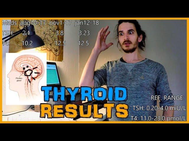 WHAT IODINE SUPPLEMENTATION DID TO MY THYROID