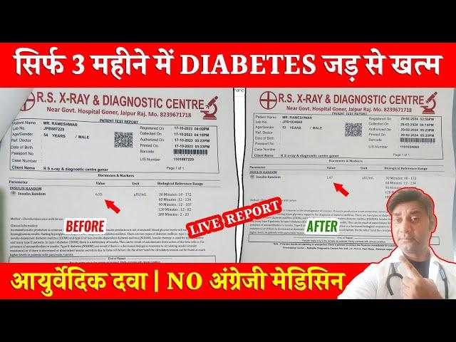 डायबिटीज मधुमेह blood sugar की बीमारी नहीं है | Diabetes is not a blood sugar disease @Dr.RajThakur