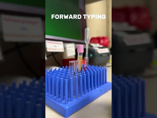 BLOOD TYPING 🩸| #bloodbank #bloodtype #lablife